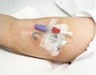 https://abtdiecut.com/wp-content/uploads/2025/07/medical-dressing.jpg